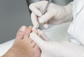 Diabetic Foot Care and Ulcers
