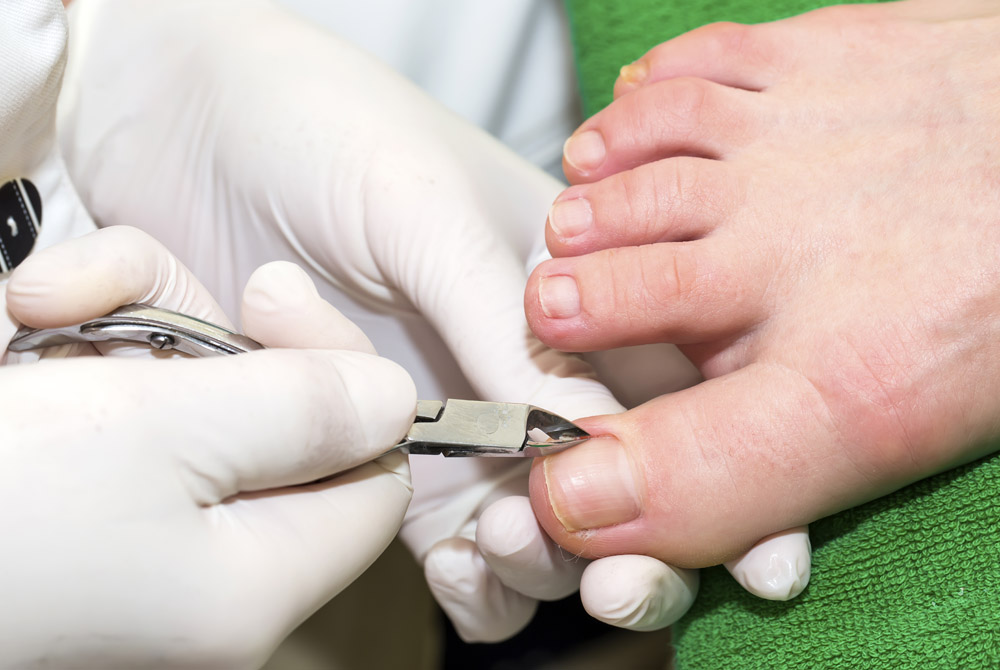 Nail Trimming Image