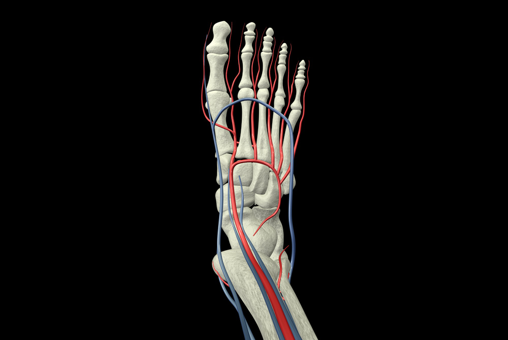 Neuroma Pinched Nerve Image