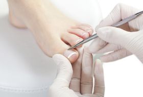 Ingrown nails & Nail Surgery